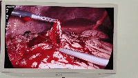 199501dd1cba9efd3beda21d98ef5360.gif