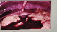 fa545a012df67510247a8b4bb450b84d.gif